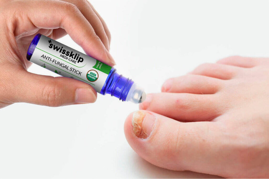 Swissklip AntiFungal Stick Review Real Results or Negative Side