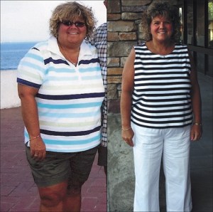 Federal Way resident Wanda Ryan before her weight loss surgery (left) and after (right). Since her surgery in July 2008