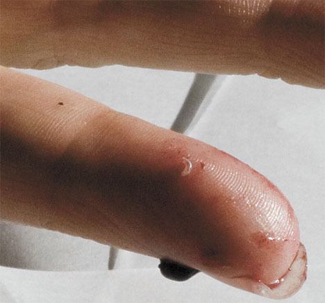 Federal Way resident Linda Sullivan found worms in her blackberries.