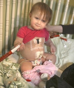 One-year-old Emma Patterson and her twin