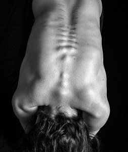 Tori Dickson recently photographed Jarstad's scoliosis surgery scars as a way to share her own story of vulnerability. Courtesy of Tori Dickson